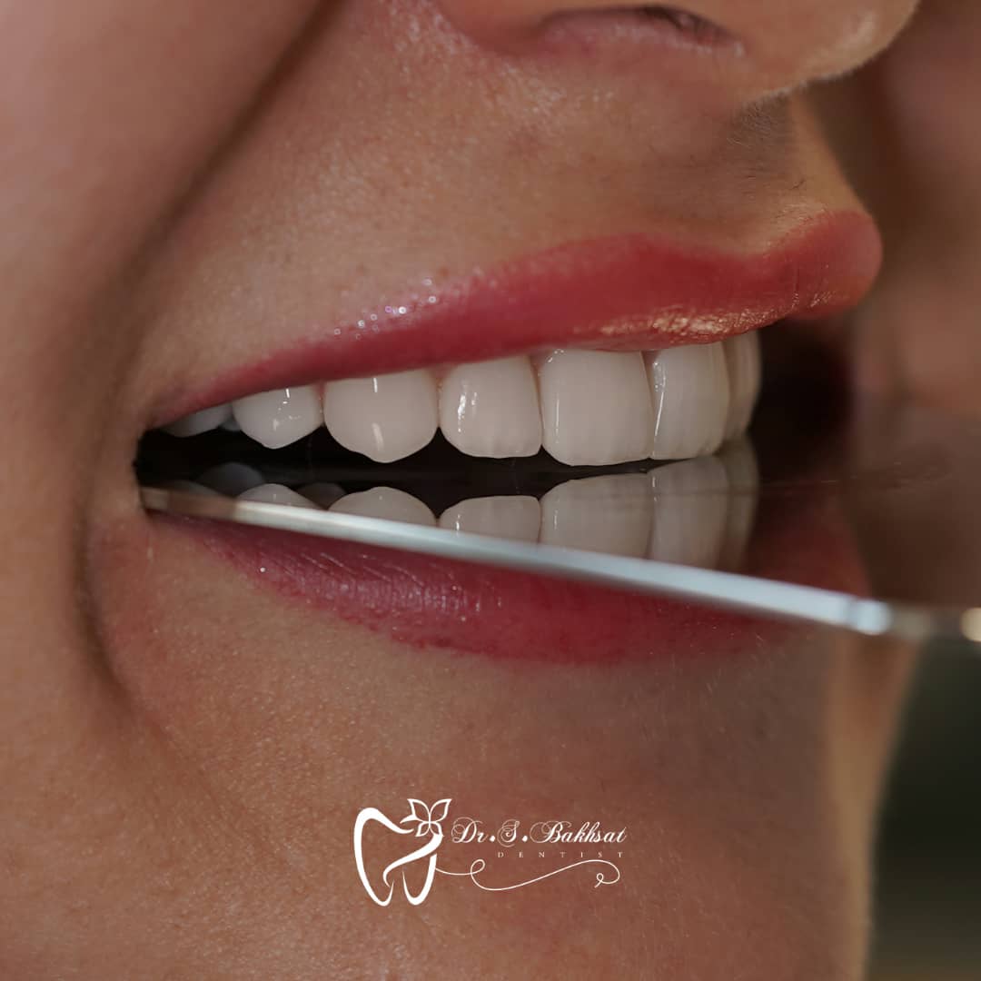 نمونه شماره3